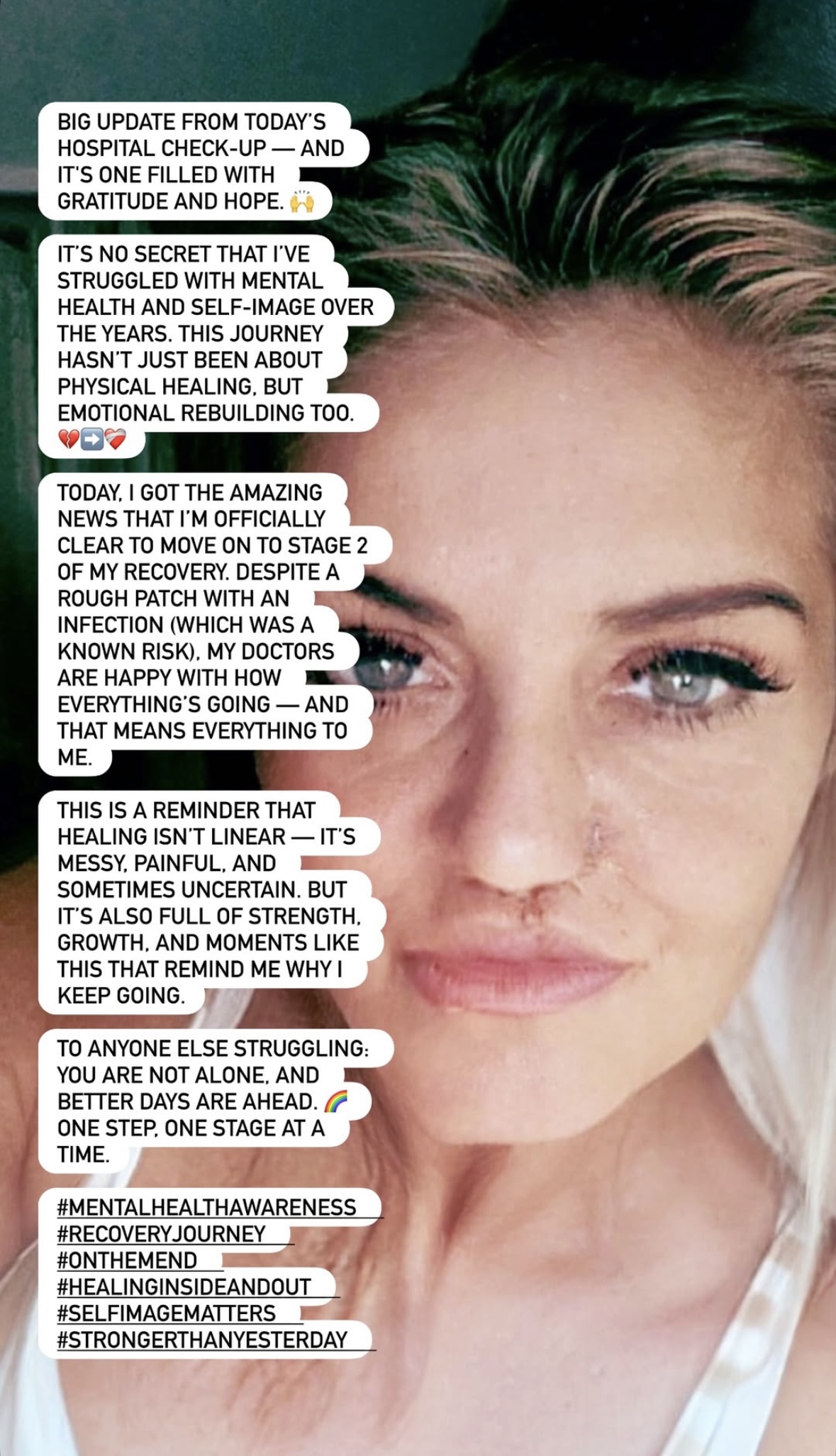 Danniella Westbrook Instagram Story