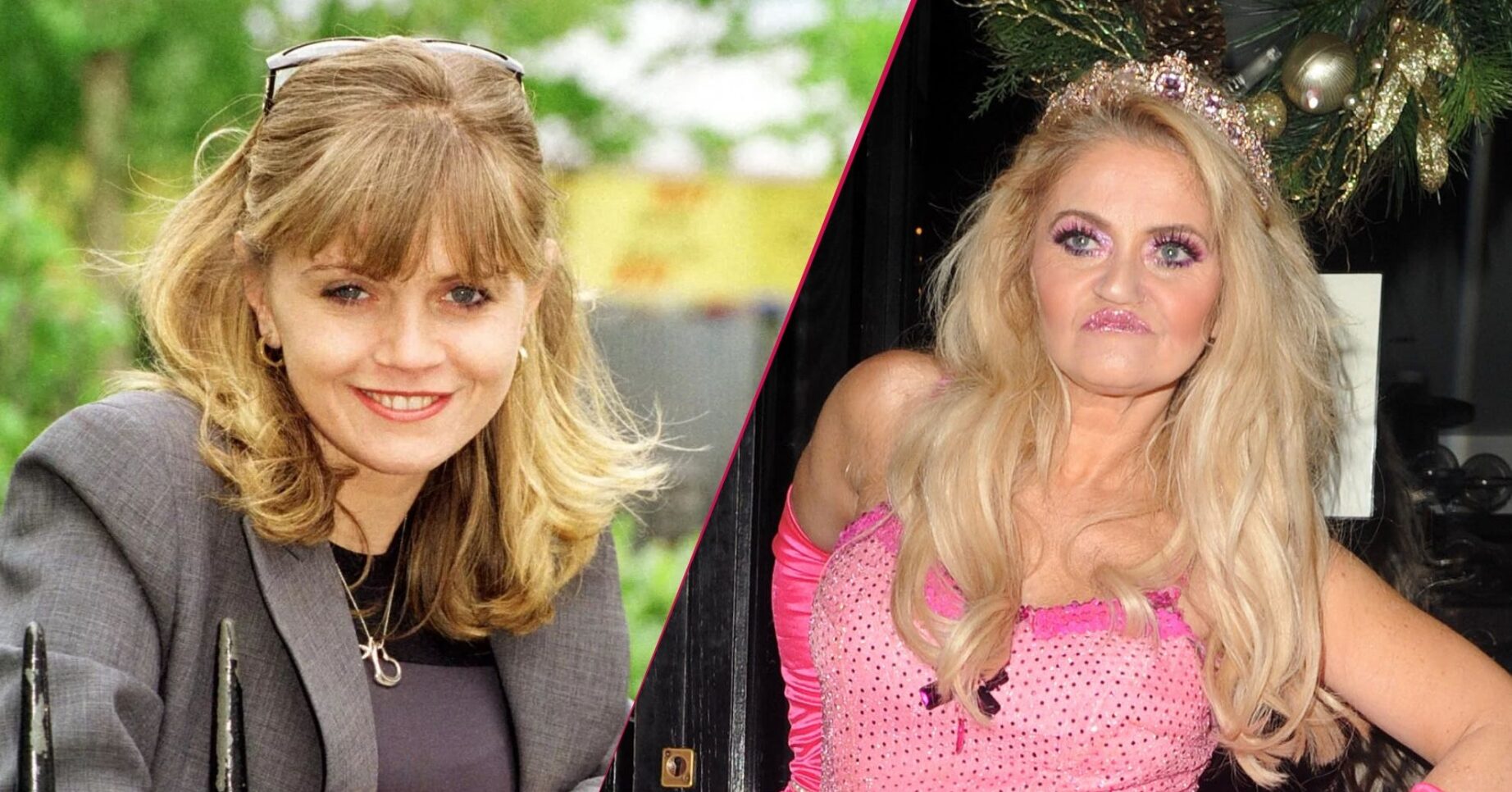 Danniella Westbrook before and after