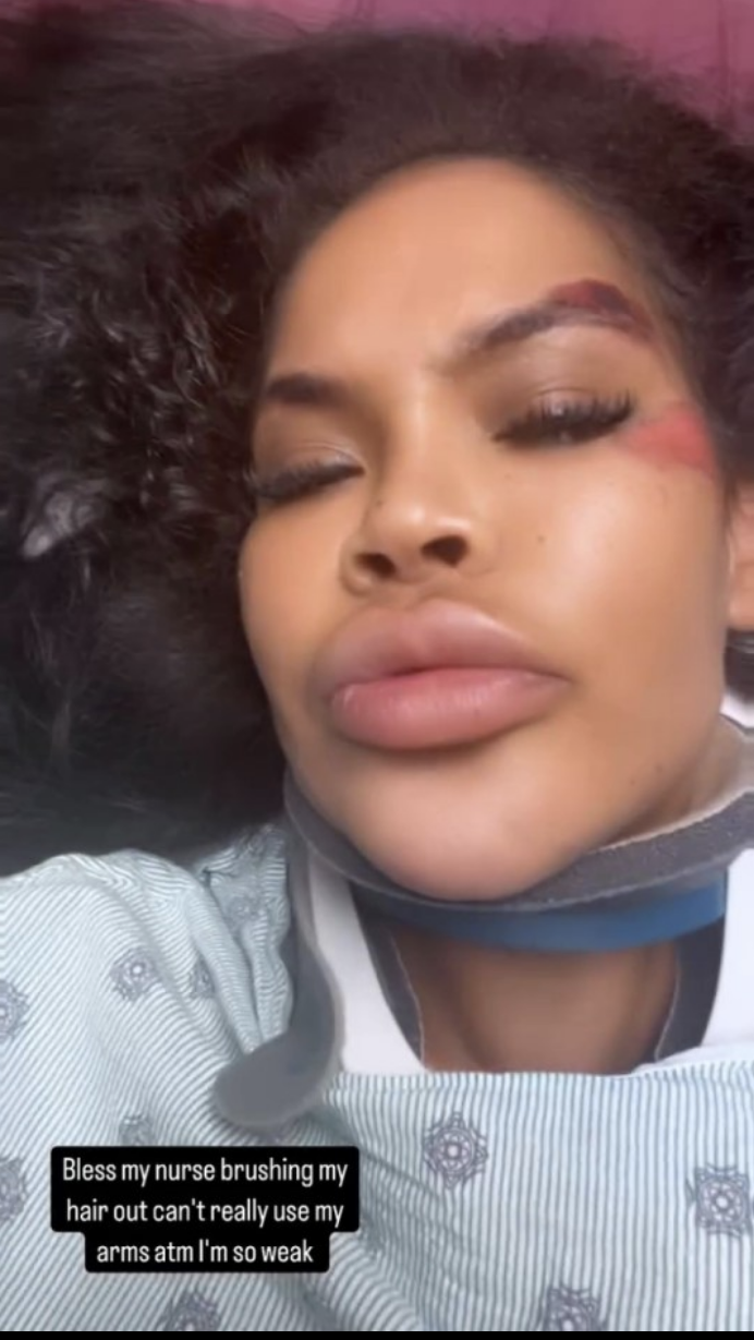 Charley Uchea in hospital