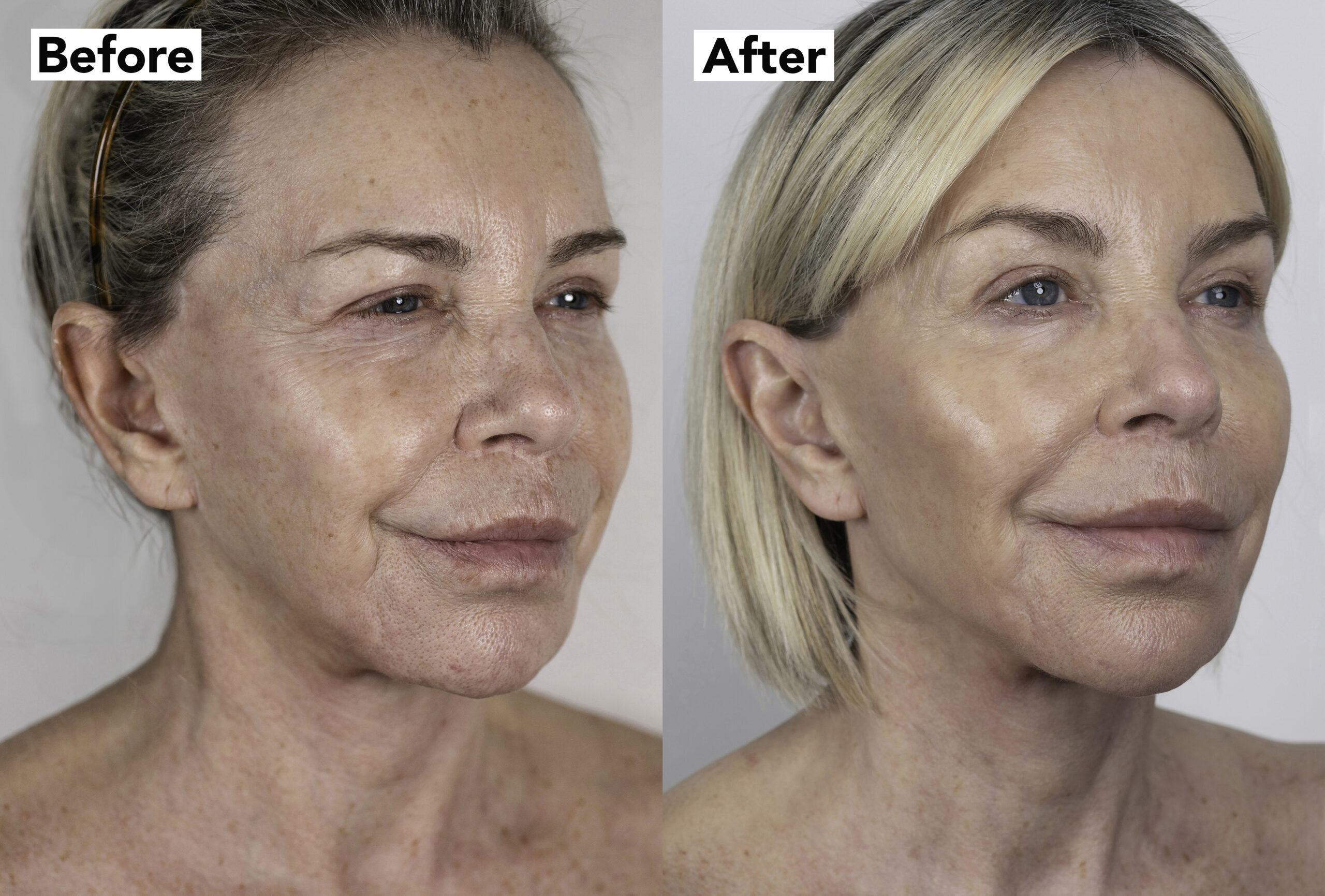 Leslie Ash before and after 