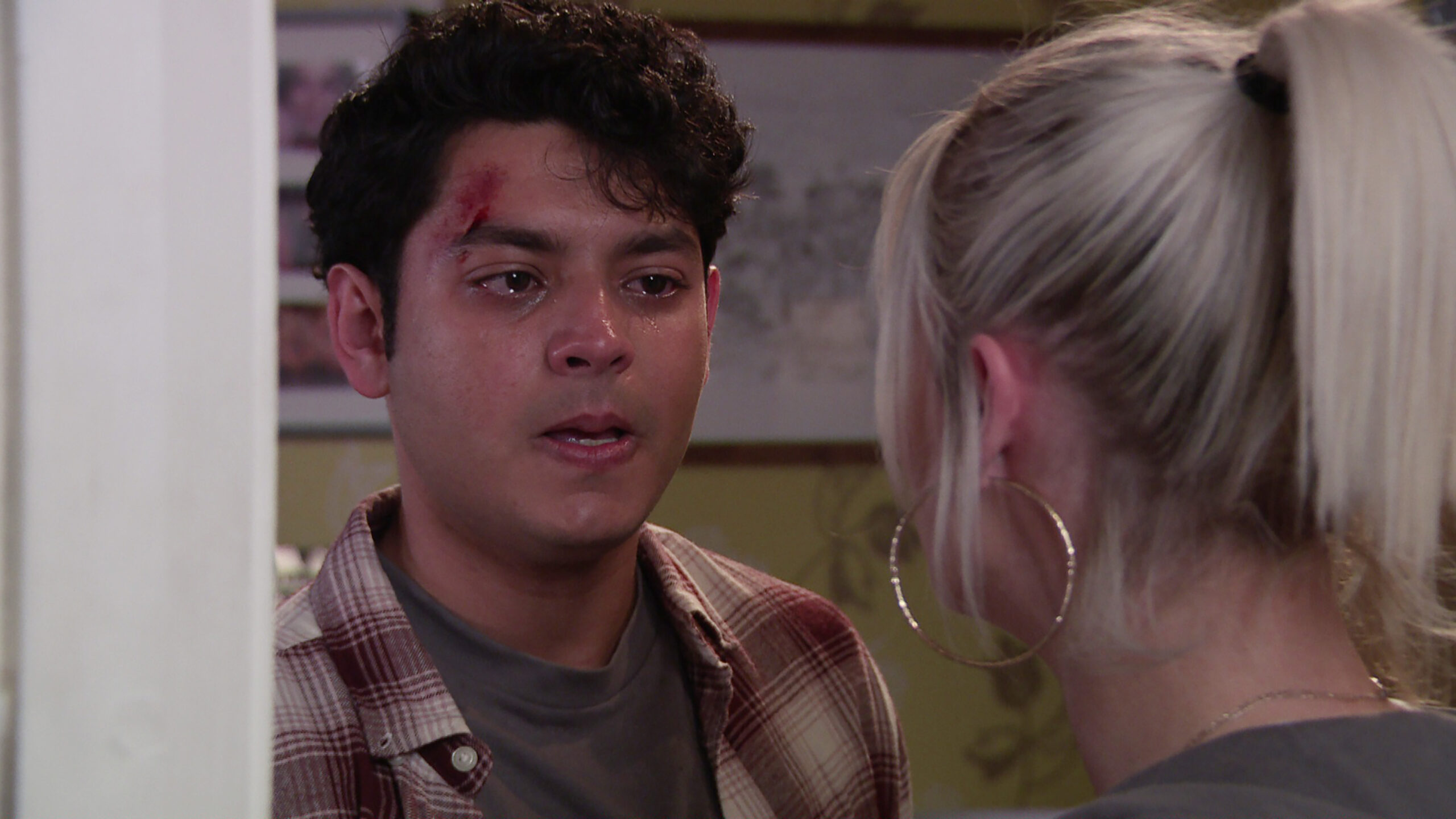 Coronation Street's Aadi with cut on face upset