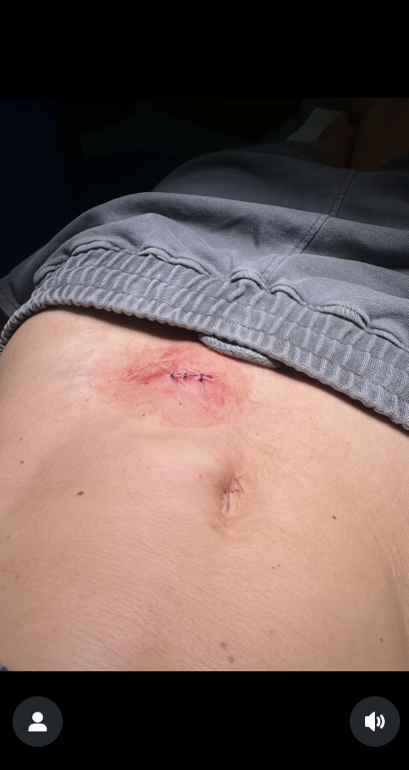 Danielle showed the cut