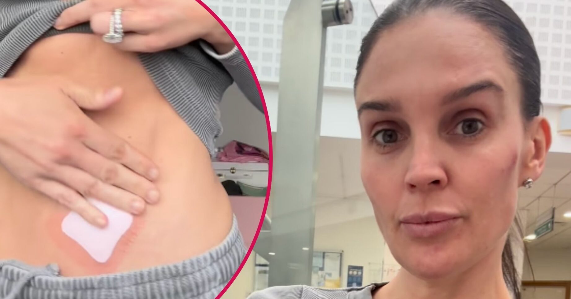 ED comp: Danielle Lloyd cancer scare