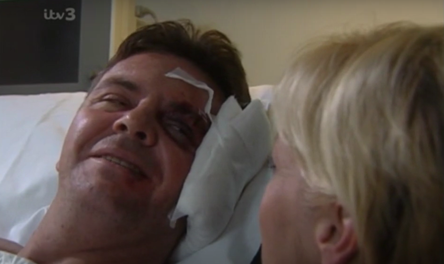 Des Barnes lays dying after being attacked