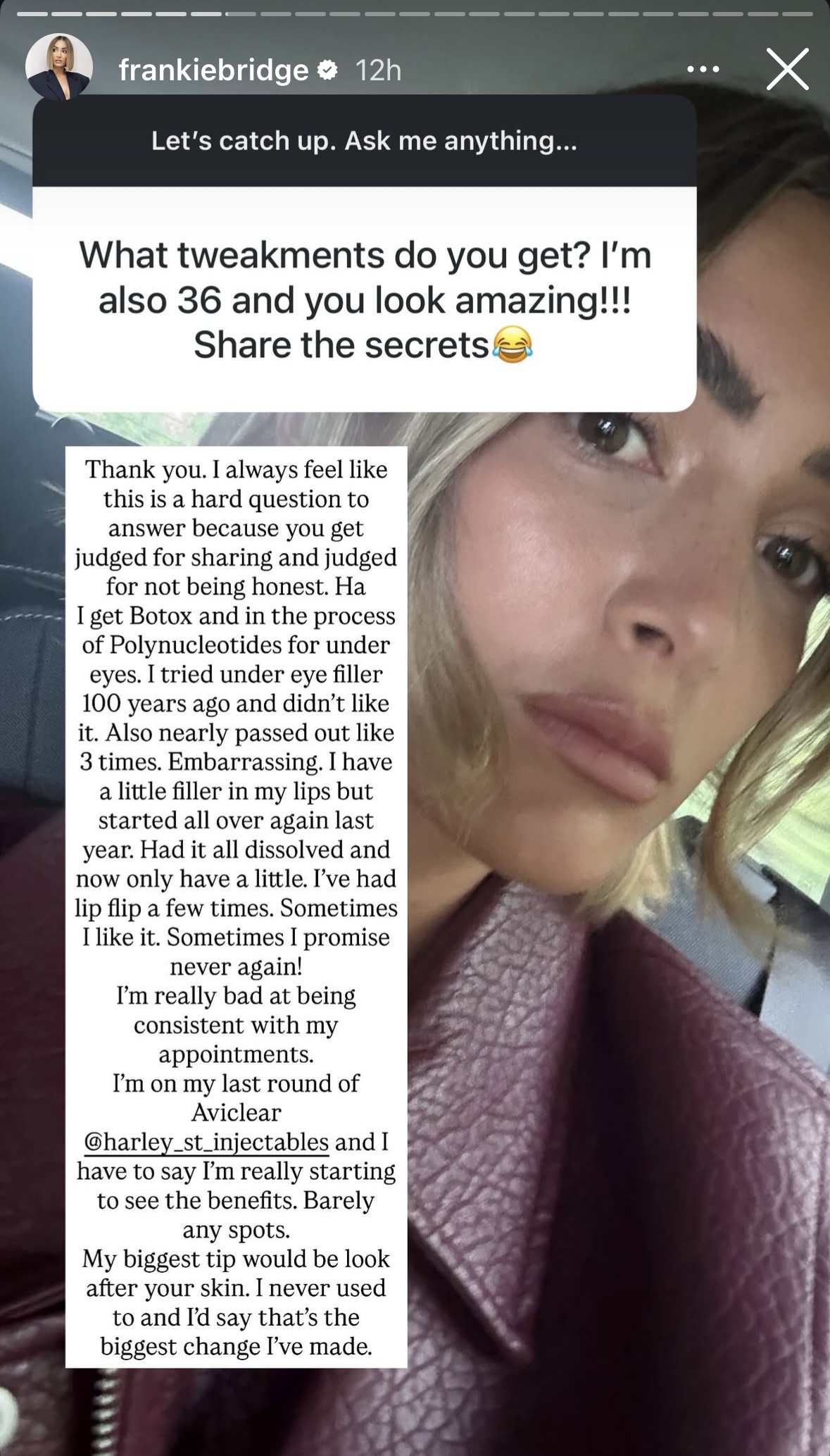 Frankie Bridge on her Instagram Story