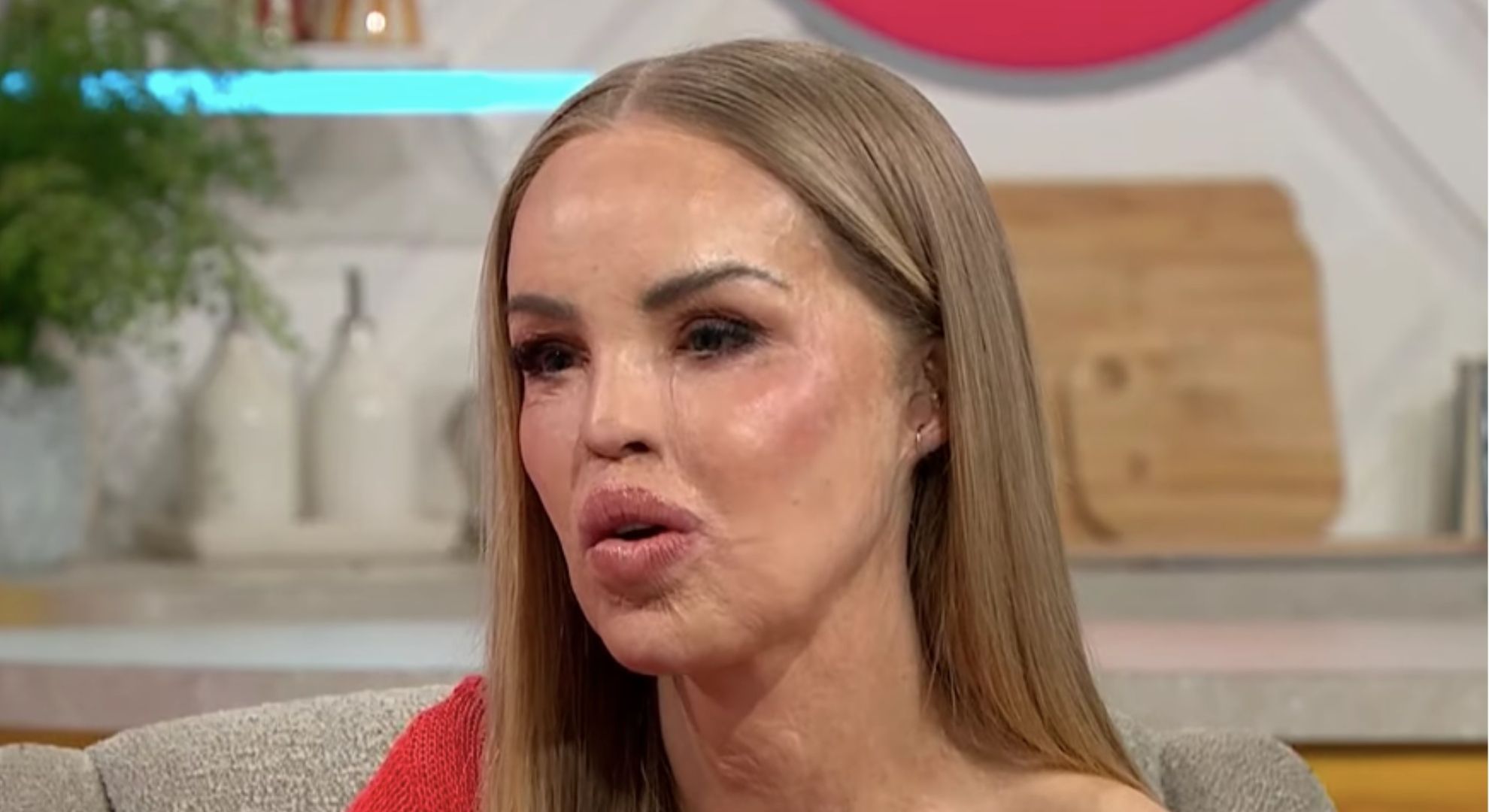 Katie Piper on daughter’s response to seeing her scars from acid attack