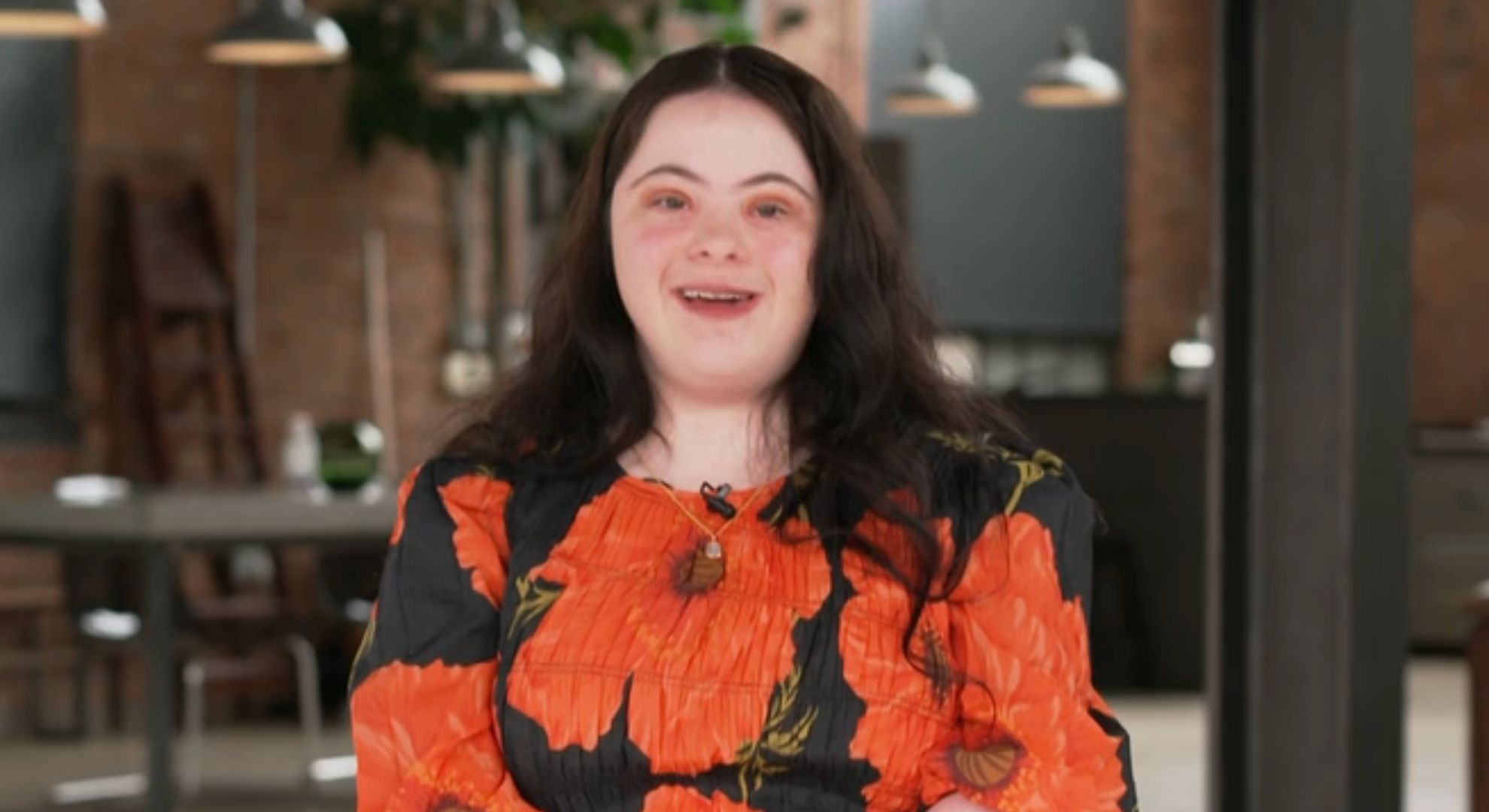 Ellie Goldstein’s parents’ worry over her 10-hour heart surgery: ‘The risks to Ellie’s life were so high’