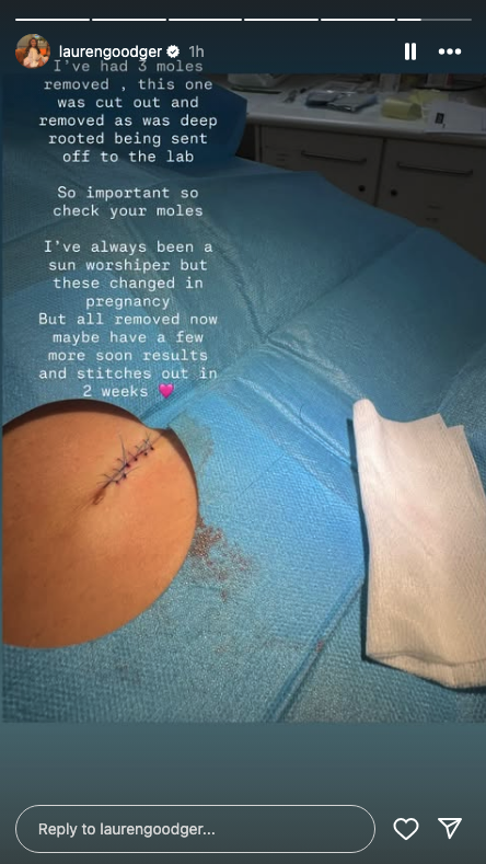 Close up of an operation