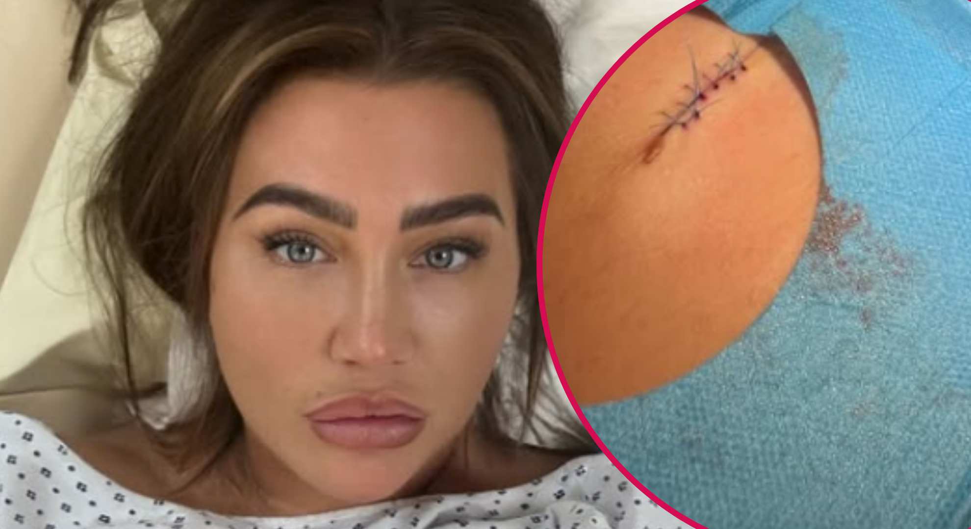 ITV star Lauren Goodger hospitalised as she issues ‘warning’ after op leaves her bloodied and bruised