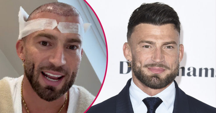 Jake Quickenden smiling and with his head in a bandage