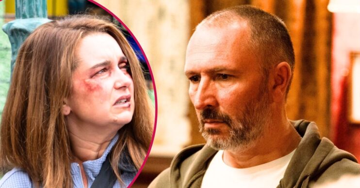 Ross looks upset on EastEnders; inset, Vicki is bruised and angry (Credit: BBC/Composite: ED!)