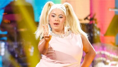 Ellie Goldstein baby spice