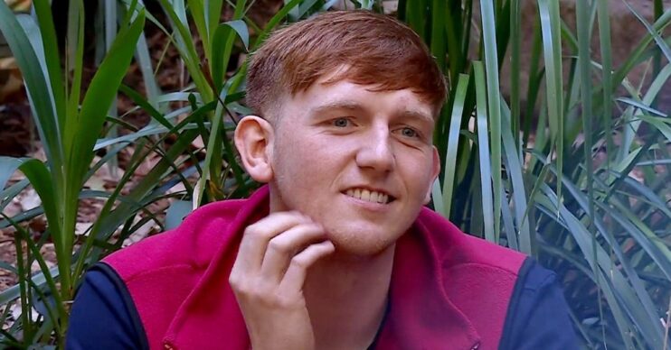Angry Ginge with his hand on his face in I'm A Celebrity Get Me Out of Here 2025