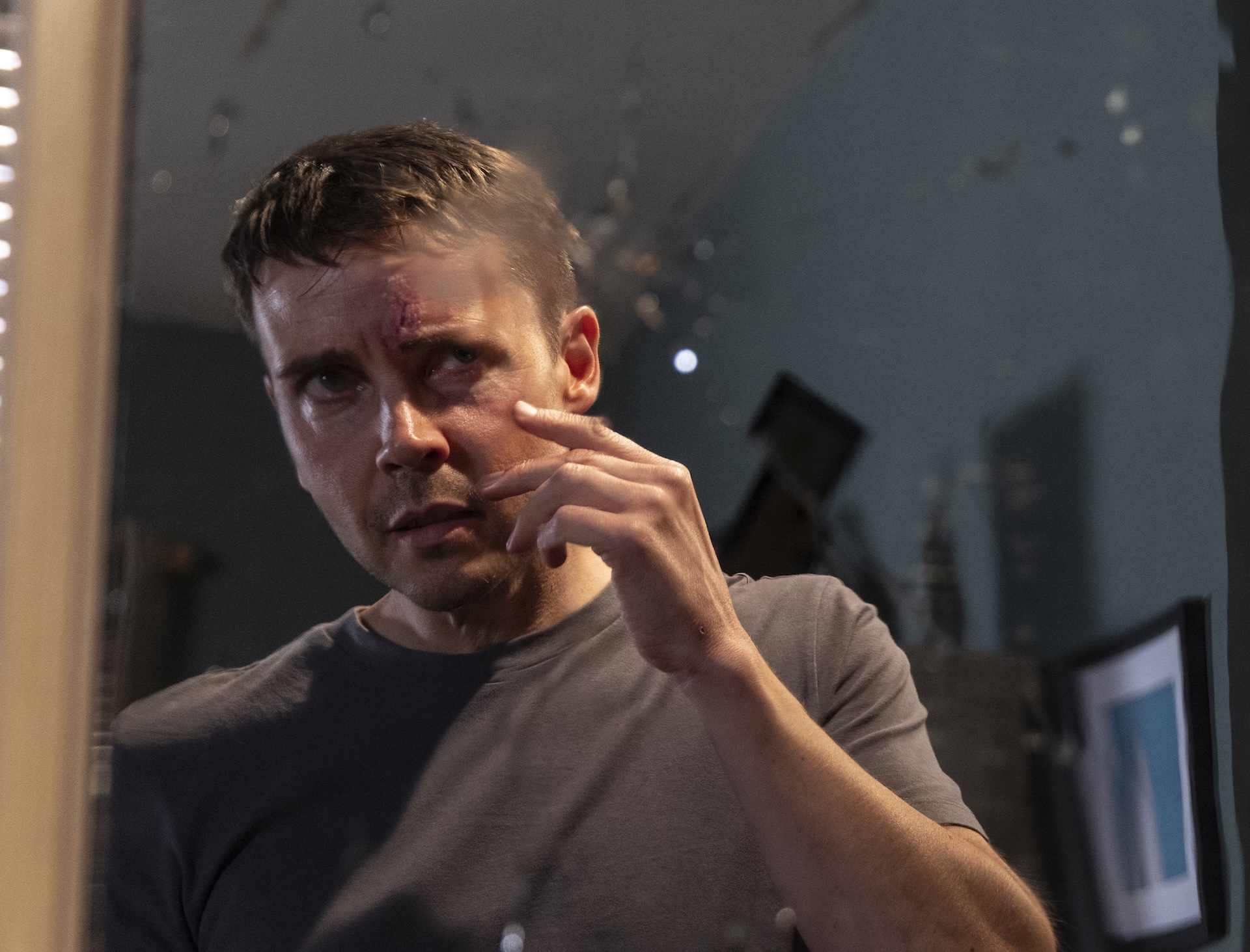 Todd staring at mark on face