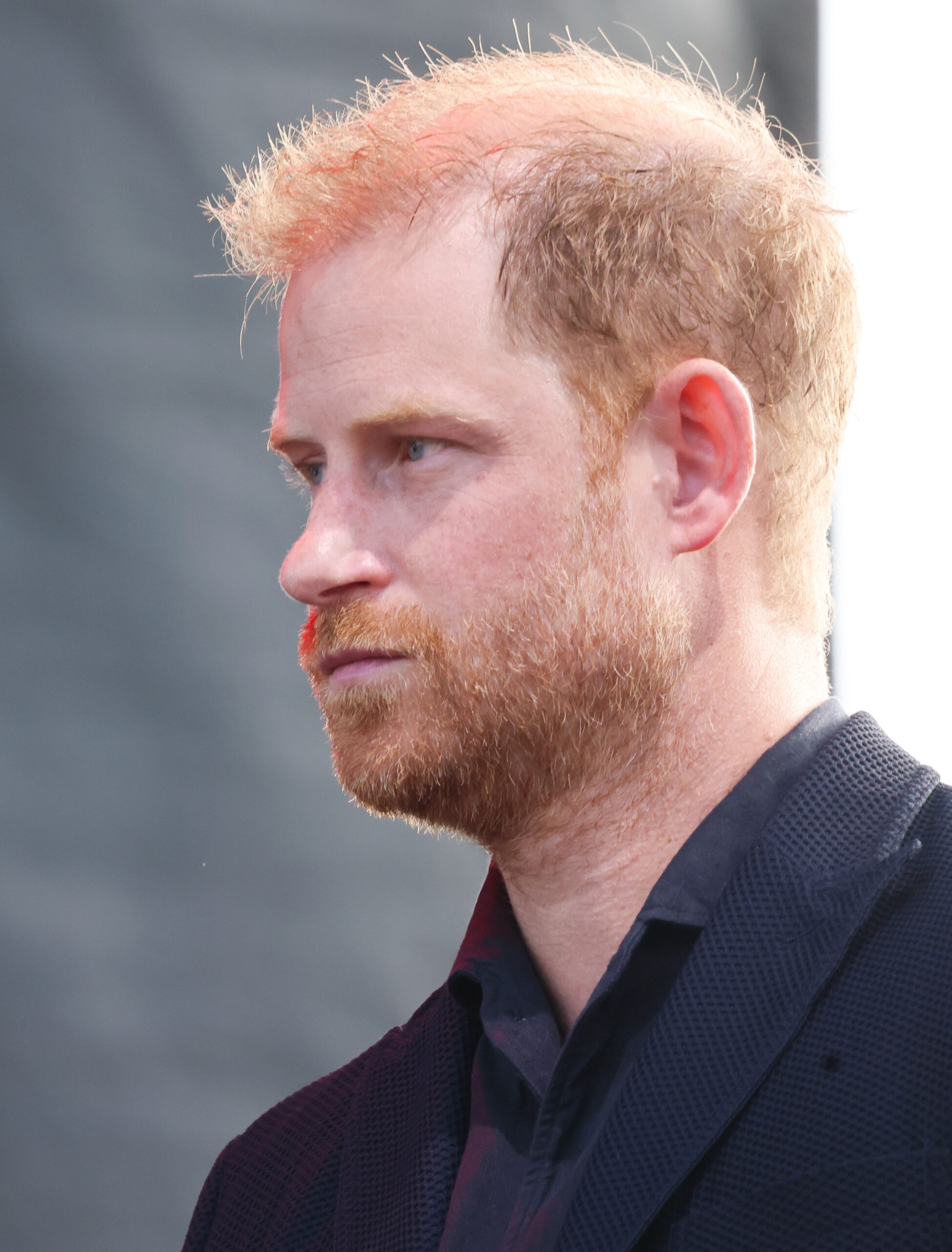 Prince Harry