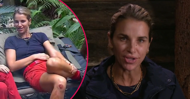 Vogue Williams on I'm A Celebrity and her bloody knee