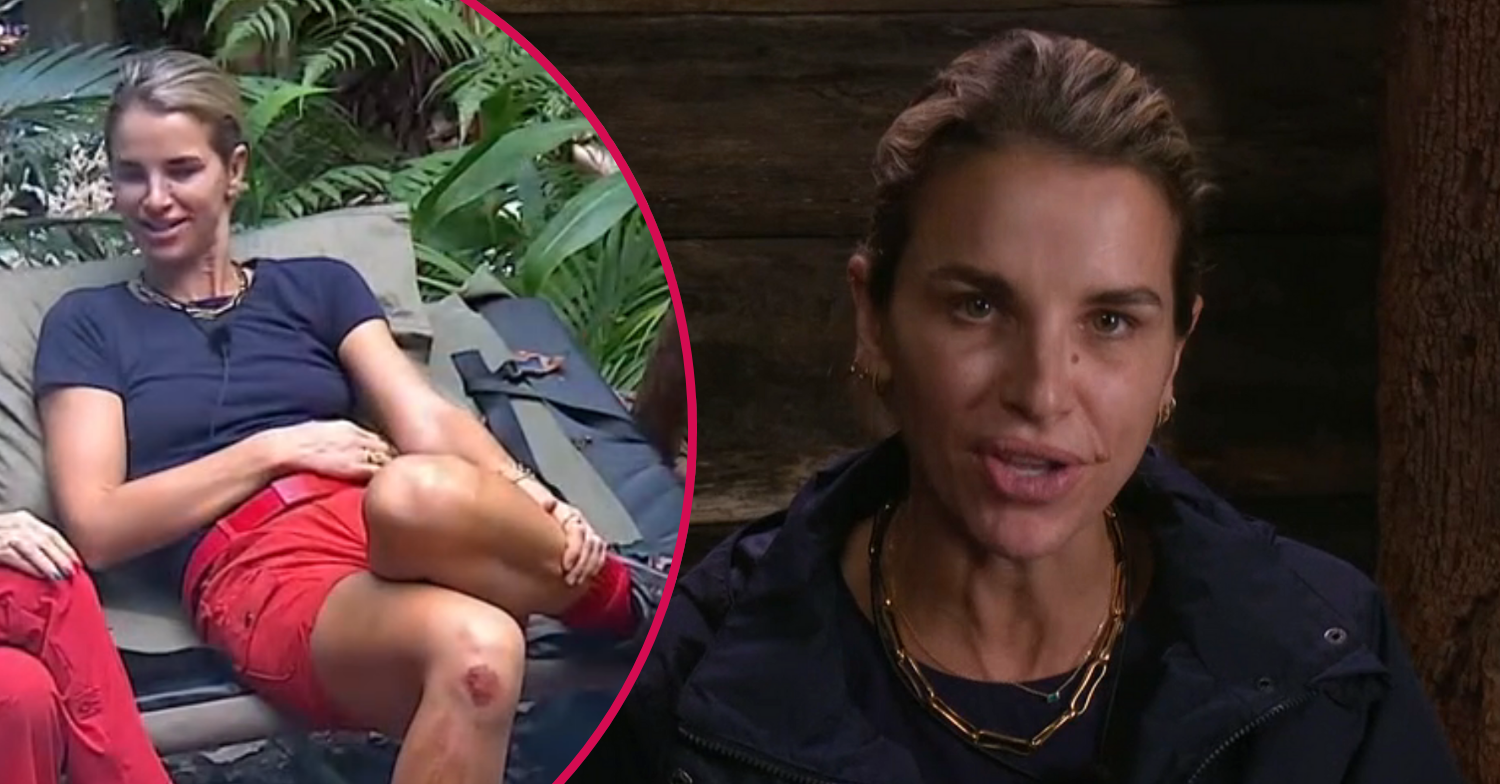 I’m A Celebrity hosts Ant and Dec share Vogue Williams injury update after star falls on bridge’ I’m A Celebrity hosts Ant and Dec share Vogue Williams injury update after star falls on bridge’
