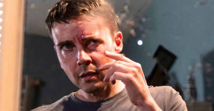 Coronation Street's Todd with cut on face