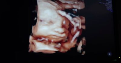 Dianne and Joe at baby scan