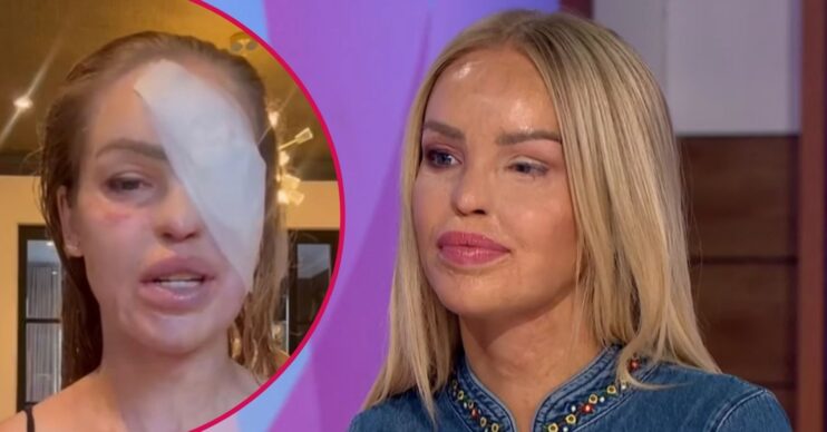 Katie piper with bandage on her face