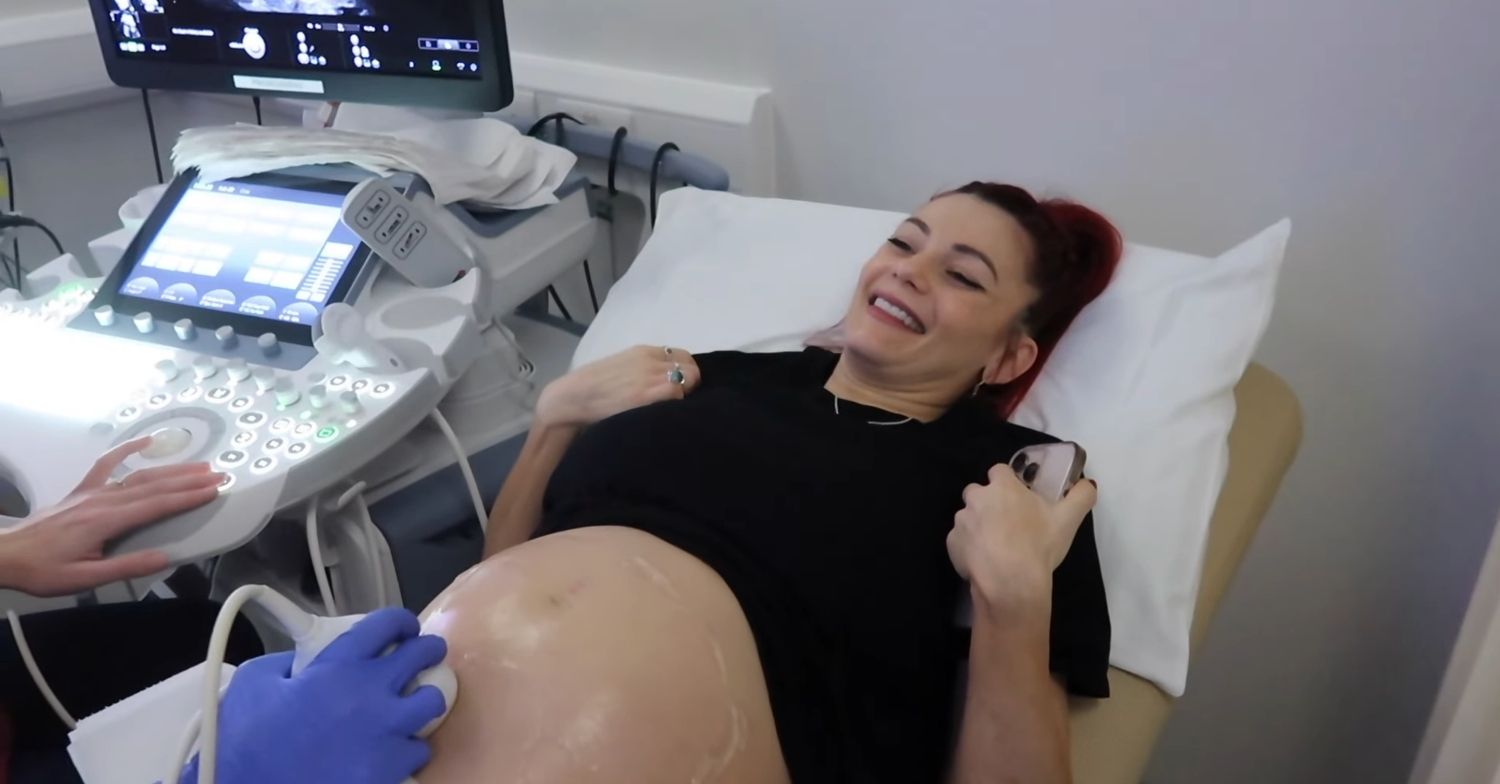 Dianne Buswell having a 4D scan