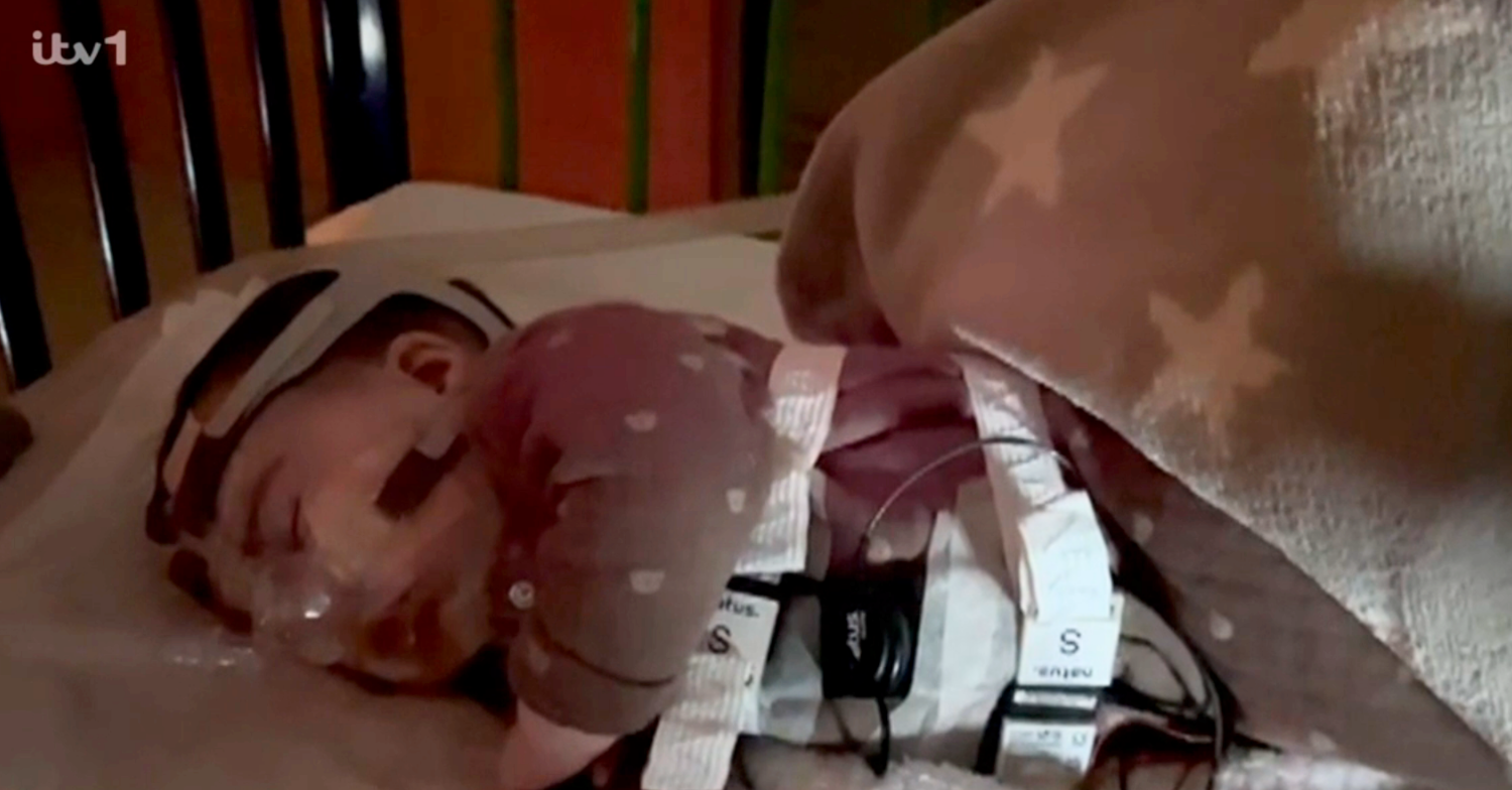 Jesy Nelson's baby on a breathing machine