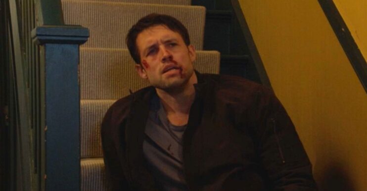 EastEnders Mark with beaten up face