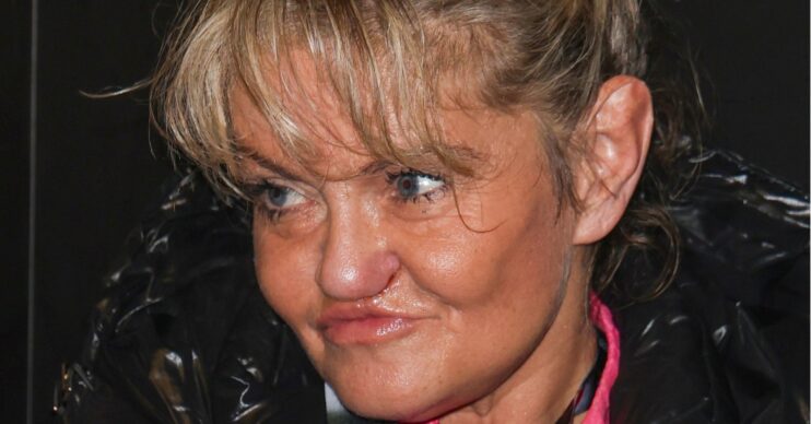 Danniella Westbrook looking to the side