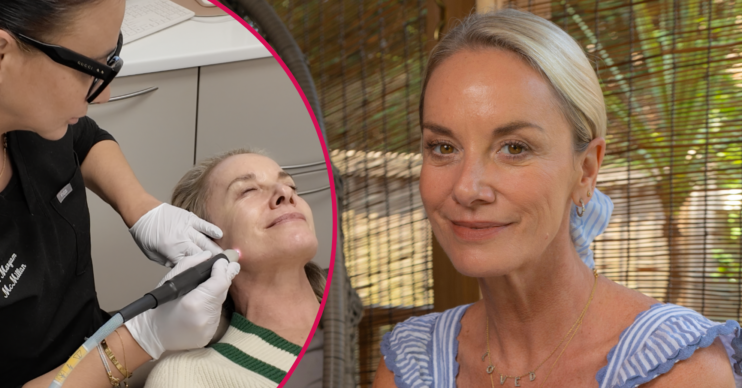 Tamzin Outhwaite smiling and having her non-surgical facelift