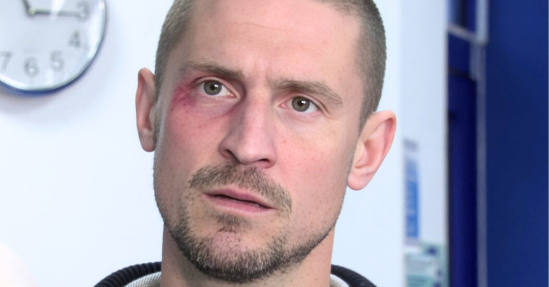 Coronation Street's Carl serious