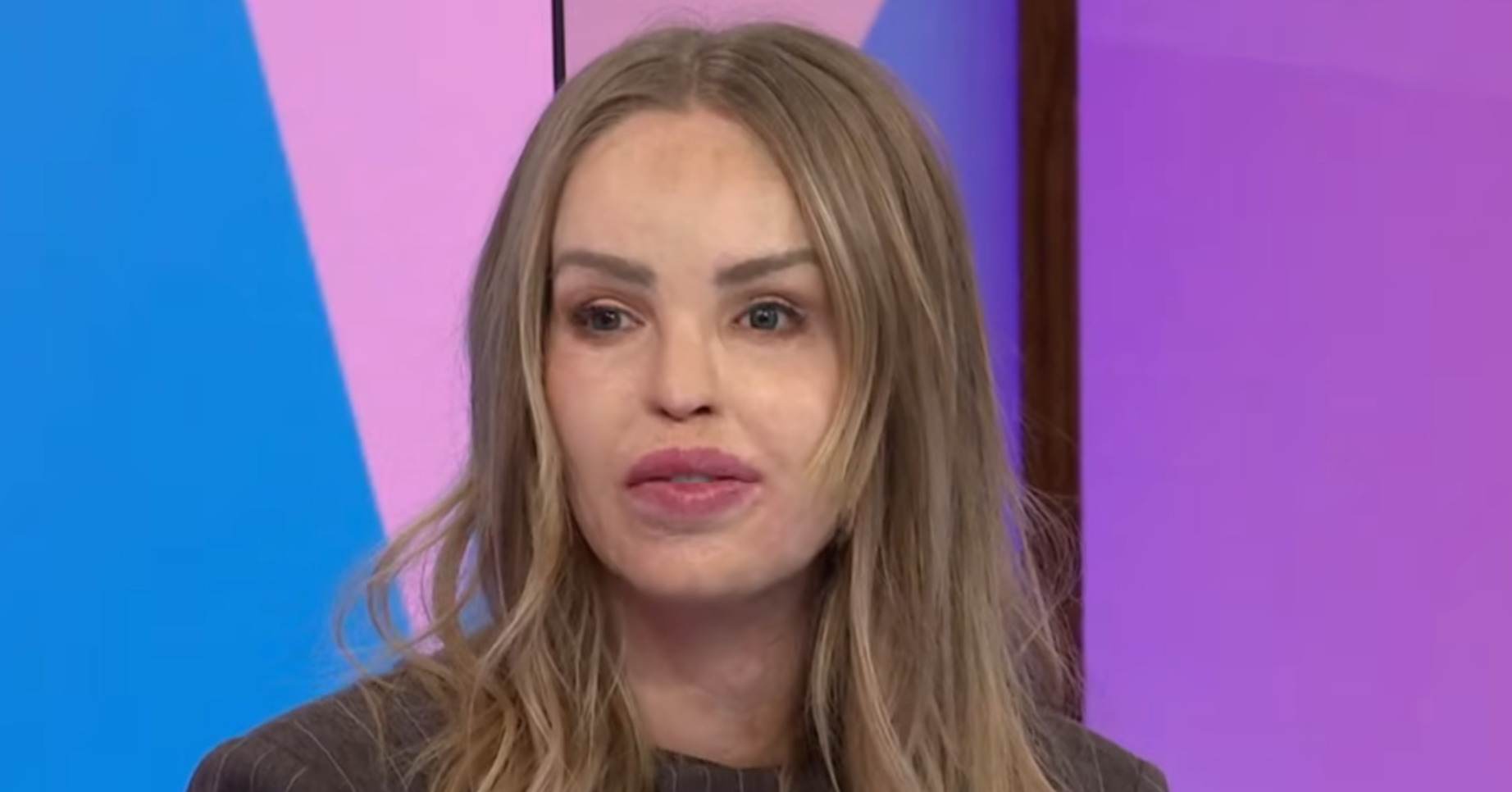 Katie Piper on Loose Women