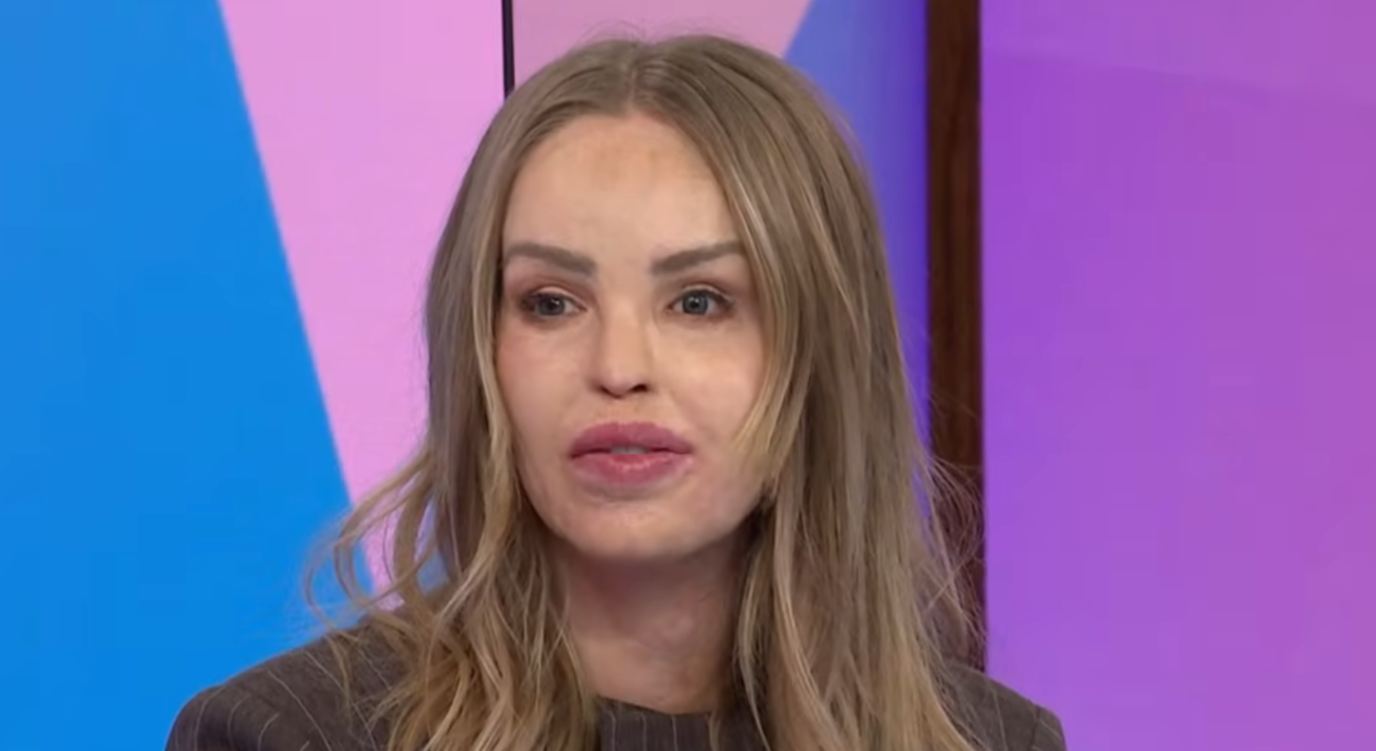 Katie Piper on Loose Women