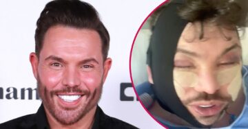 TOWIE’s Bobby Norris, 39, sparks huge concern as he shows off bloodied and bruised face following surgery