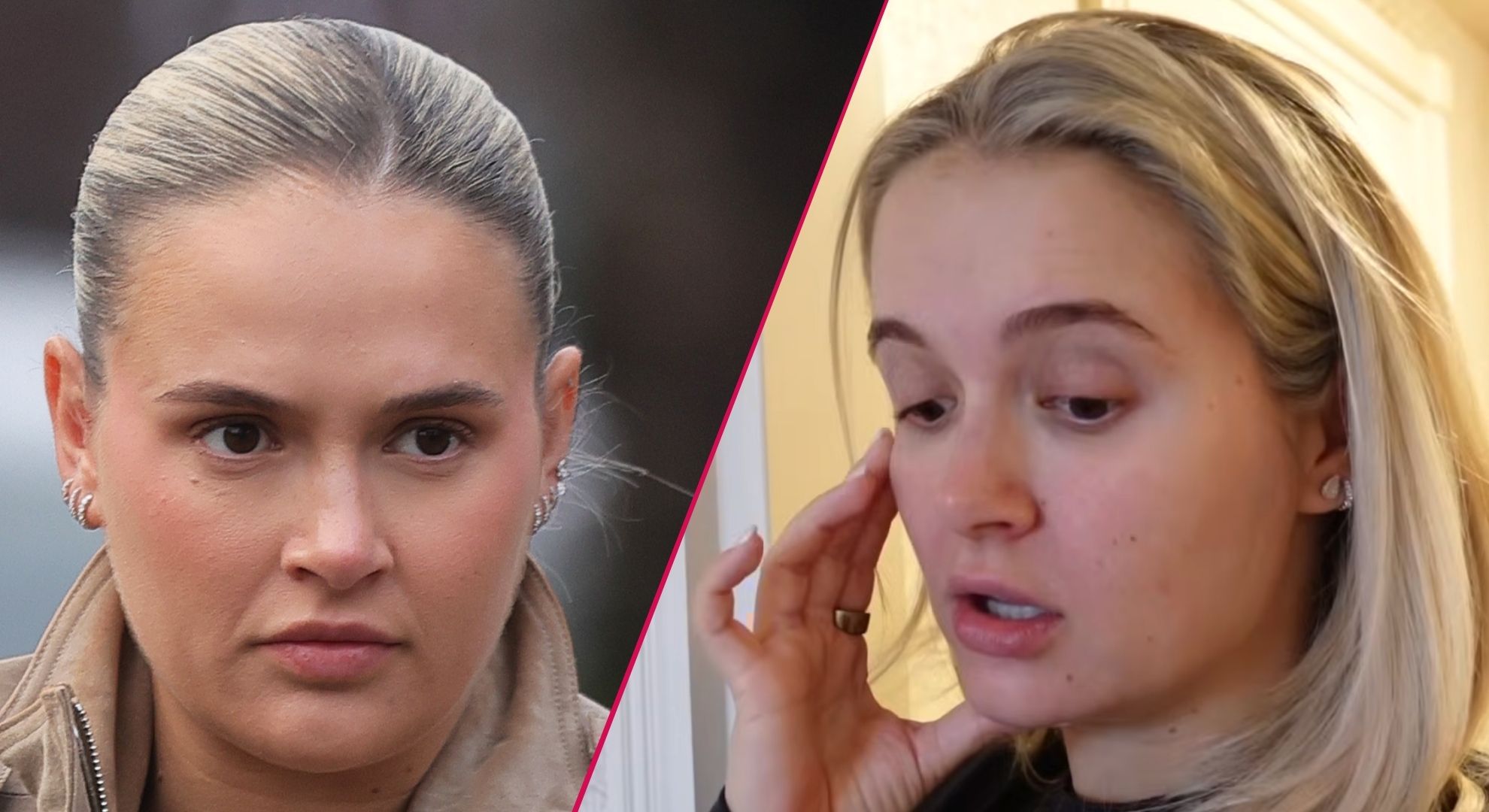 ‘Broken’ Molly-Mae Hague reveals ‘painful’ health condition that’s left her considering professional help: ‘I’m not feeling myself’