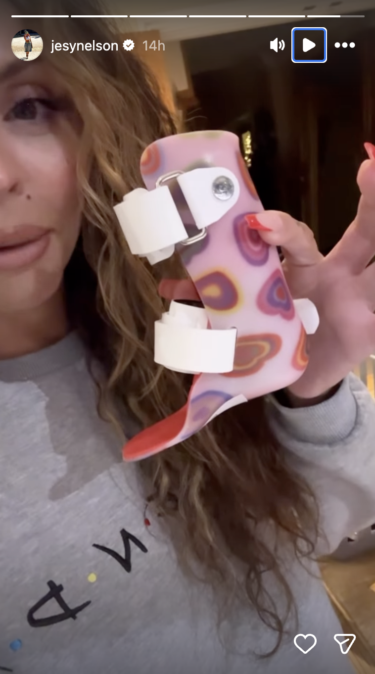 Jesy Nelson showing leg splint 