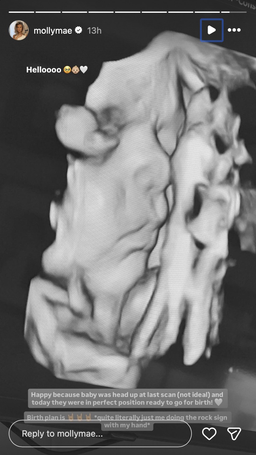 Molly-Mae Hague unborn baby scan