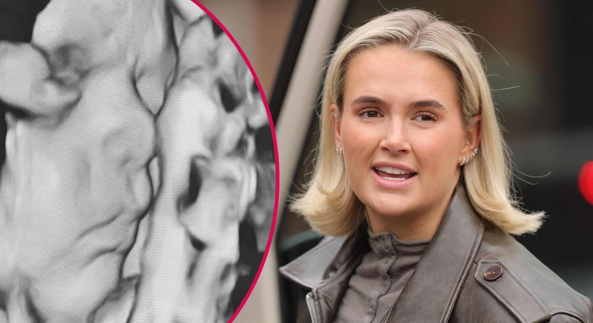 Pregnant Molly-Mae Hague emotional as she shares gorgeous first-look at her unborn baby’s face