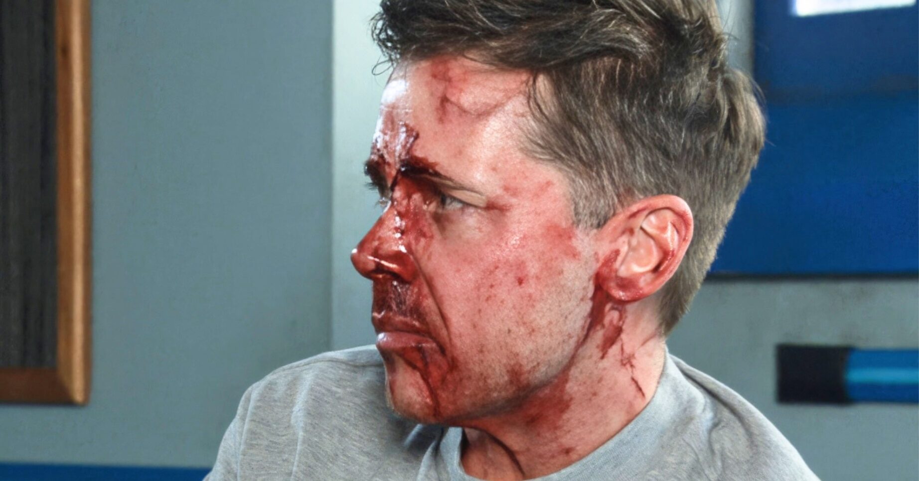 Coronation Street's Todd bloodied and bruised