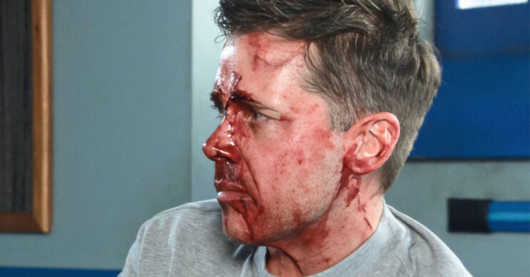 Coronation Street's Todd bloodied and bruised