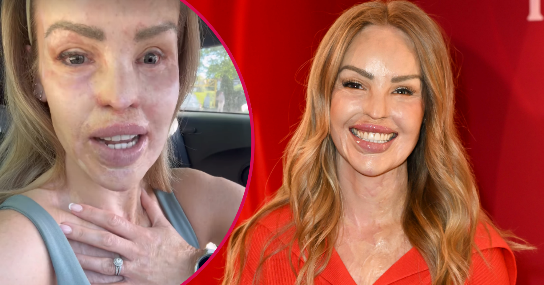 Katie Piper smiling and talking in her car