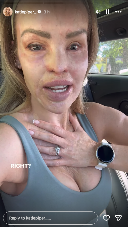 Katie Piper speaking to camera in her car