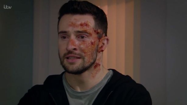 Ross had viewers sobbing with his reaction in Emmerdale