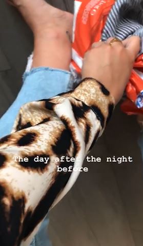 Lucy Fallon soothes her sore foot after British Soap Awards
