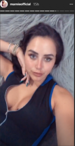 Marnie Simpson after nose job (Credit: Instagram)