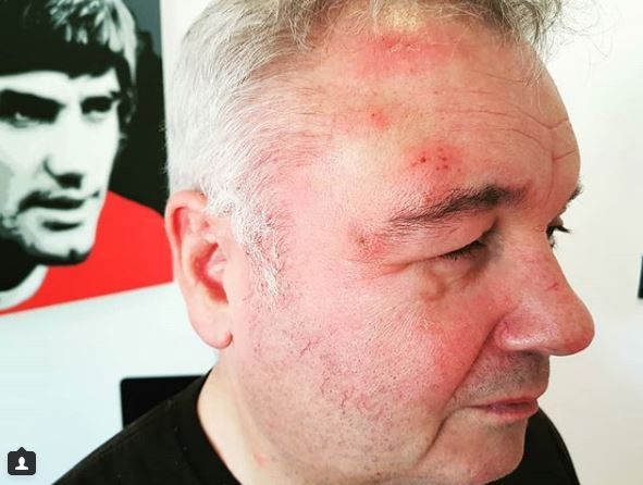 Instagram @eamonnholmes 