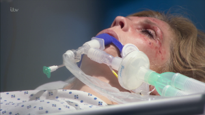 Bernice was left in a coma after a reaction to dodgy Botox (Credit: ITV)