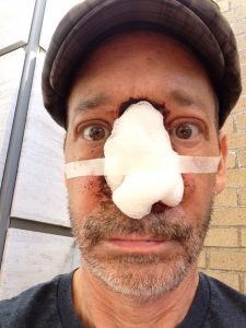 Steve Bean