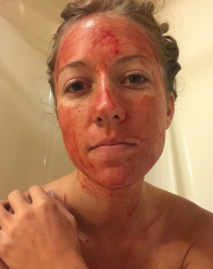 Demetra has promised to post photos of herself smeared in blood every month (Credit: Instagram @demetra_nyx)
