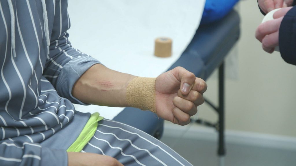 The Dancing On Ice physio said a small bone popped out of his wrist