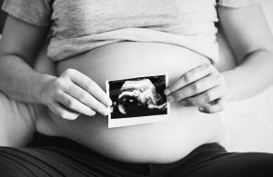 Woman with baby scan